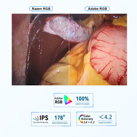 Système d'endoscopie vétérinaire portable FHD, caméra d'imagerie pour endoscopie animale, dispositif pour hôpital vétérinaire