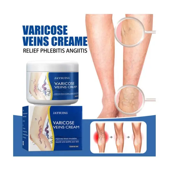 Jaysuing Entlastung Phlebitis Angiitis Dredge Vene Smooth Varicose Veins Creme für Bein/Bein und Rückenschmerzen Linderungscreme