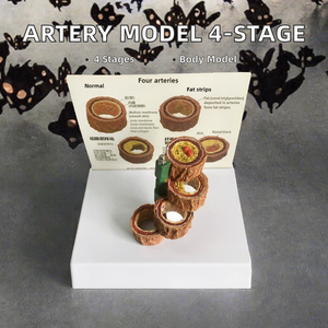Modelo vascular humano anatómico de cuatro etapas para la ciencia médica que ilustra la <span class=keywords><strong>arteriosclerosis</strong></span> y la <span class=keywords><strong>enfermedad</strong></span> vascular - Product Image 3