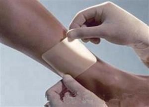 Pengobatan medis hidrokoloid perban melepuh plester luka bakar - Product Image 6