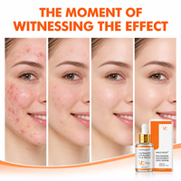 Gel Réparateur Rapide et Efficace Contre les Cicatrices d'Acné et les Taches, Lisse la Peau, Resserre les Pores, Sérum Anti-Acné OEM ODM