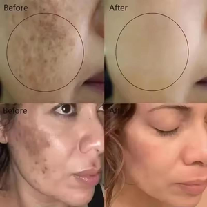 <span class=keywords><strong>Corrector</strong></span> de Manchas Oscuras de Marca Privada de 50 g, Crema Facial Iluminadora de la Piel, Antienvejecimiento, Beneficios Reafirmantes y Nutritivos, Vegano, Herbal, Orgánico - Product Image 5