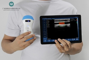 B26E Instrumentos de ultrasonido médico para el embarazo máquina de ultrasonido cardíaco de mano mini escáner de ultrasonido portátil - Product Image 5