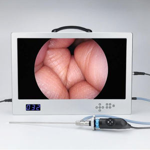 1080P 24 인치 4 in 1 통합 의료 진단 장비 비디오 카메라 시스템 일체형 휴대용 HD 내시경 카메라 - Product Image 6