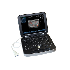 Échographe vétérinaire portable Periodmed avec écran LED de 15 pouces, batterie intégrée et stockage de 500 Go, garantie de 5 ans, VL152B Periodmed - Product Image 1