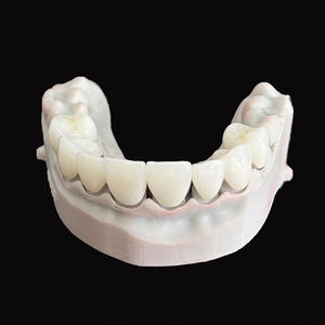 Couronnes et ponts dentaires <span class=keywords><strong>en</strong></span> <span class=keywords><strong>zircone</strong></span> <span class=keywords><strong>en</strong></span> couches de porcelaine avec gomme <span class=keywords><strong>en</strong></span> porcelaine pour dents antérieures - Product Image 2