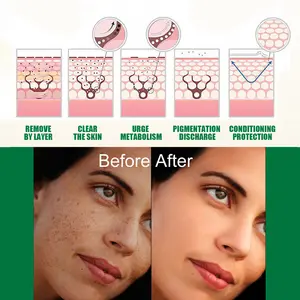 OEM Private Label Dark Spot Treatment essenza cura della pelle coreana schiarente siero pianta squalano che illumina la pelle senza crudeltà
