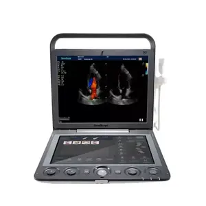 Echography medis mesin Ultrasound portabel 3D 4D Promosi sonosape S9 - Product Image 1