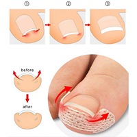 Nouveaux patchs correcteurs d'ongles respirants de formes variées