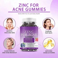 Gummies anti-acné OEM : Nettoyant et lissant pour la peau, Vitamine anti-imperfections, Produit de beauté sans gluten pour estomper les taches brunes