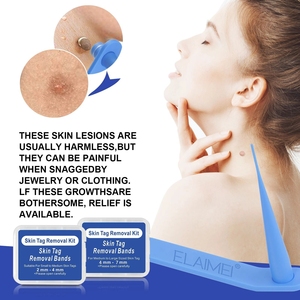 Kit penghilang tahi lalat penggunaan di rumah, Kit peralatan penghilang tahi lalat mikro, perawatan kulit - Product Image 3