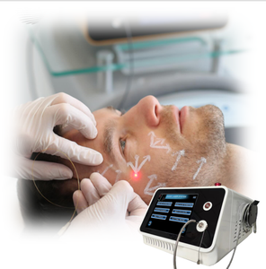 Appareil de liposuccion Microair, laser diode 1470 nm, laser facial à fibre 980 nm, lifting du visage, double <span class=keywords><strong>menton</strong></span>, lipo laser, lifting du visage - Product Image 2
