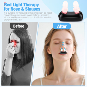 Uoyo Tragbares 650nm Rotlicht Nasen-Physiotherapiegerät - Gegen Schwellungen & zur Förderung der Durchblutung, Linderung von Nasenbeschwerden - Product Image 4
