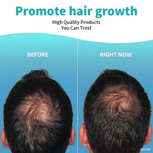 Aceite Capilar con Biotina y Colágeno OEM, 4 FL.OZ, Producto <span class=keywords><strong>de</strong></span> Belleza para el Crecimiento del Cabello, Reduce la Caída del Cabello, Nutre el Cabello, Controla el Frizz, Mejora el Aspecto - Product Image 4