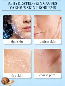 Crème professionnelle à la mucine d'<span class=keywords><strong>escargot</strong></span> - Hydratante et anti-acné, adaptée à la routine quotidienne de soins de la peau - Product Image 3