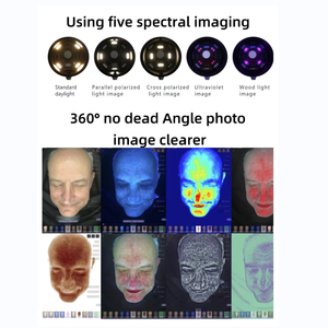 Taşınabilir 3D yüz cilt analiz makinesi tarayıcı BV cilt analiz cihazı bir ağ bağlantısına ihtiyaç duymaz - Product Image 4