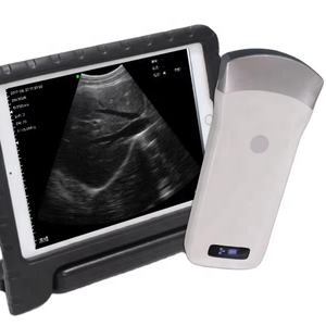 Susured C3.5 Wifi Ultrasound <span class=keywords><strong>Probe</strong></span> nirkabel Ultrasound <span class=keywords><strong>Probe</strong></span> 3.5 MHZ 80 elemen mesin Ultrasound - Product Image 1