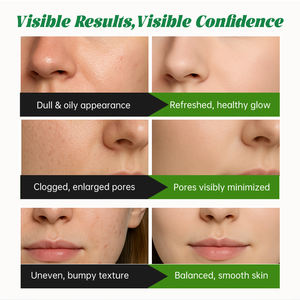 <span class=keywords><strong>Masque</strong></span> exfoliant moussant au charbon de bambou ODM pour le visage, à l'acide salicylique, nettoyage en profondeur des pores, hydratant, apaisant, affine la peau, pour tous types de peau - Product Image 4