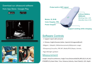Sistema <span class=keywords><strong>de</strong></span> Ecografía Portátil Inalámbrico USB para Hospital, Sonda Convexa Cardíaca Lineal para Teléfono/Tablet, <span class=keywords><strong>de</strong></span> Plástico Eléctrico - Product Image 5