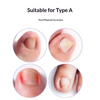 Patchs de Correction des Ongles - Coussinets Redresseurs d'Ongles - Traitement des Ongles Incarnés - Patchs Auto-Adhésifs à Tirer vers le Haut - Sans Colle Requise