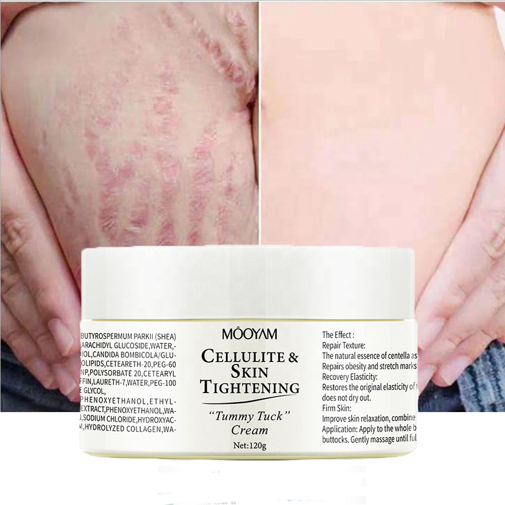 Label Pribadi Krim Penghilang Selulit dan Stretch Mark Organik Tubuh Tummy Tuck Mengencangkan Stretch Mark