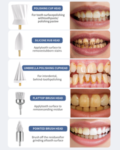 Multifunzionale elettrico denti denti lucidatrice con 5 spazzole lucidatura denti sbiancamento accessori per la pulizia nuovo titolo - Product Image 5