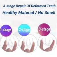 Appareil orthodontique dentaire professionnel en silicone pour l'alignement des dents et le redressement des dents