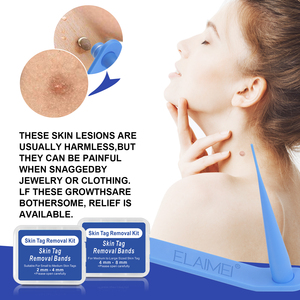 Kit de Eliminación de Verrugas ELAIMEI 2 en 1, Herramienta Indolora para Eliminar Verrugas, 40 Bandas, Envío Inmediato, Disponible en Almacén en el Extranjero - Product Image 2
