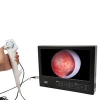 Cámara endoscópica Full HD portátil de 24 pulgadas para equipo de cirugía ENT/Urología/laparoscopia/histeroscopia/cistoscopia
