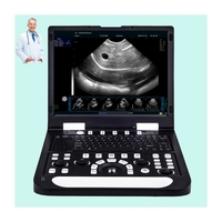 Guide de ponction pour lithotripsie, écran médical 15 pouces, scanner à ultrasons, SSD 128 Go, onde pulsée pour diagnostics chirurgicaux