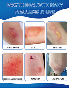 Haute efficacité brûlure brûlure feu brûlure soins de guérison pommade premiers soins à base de plantes réparation récupération brûlures Anti-Infection crème blessé - Product Image 4