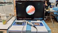 Caméra endoscopique portable électrique HD IKEDA YKD-9122 avec écran 22 pouces, construction métal-plastique, pour ORL/laparoscopie/hystéroscopie/urologie