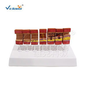 Modelo de tarjeta anatómica para enseñanza médica, modelo de Ciencia de arteriosclerosis y vasos sanguíneos - Product Image 1