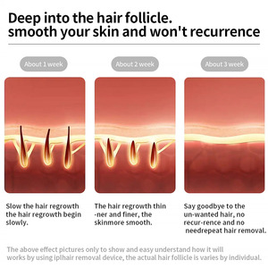 เครื่องกำจัดขน <span class=keywords><strong>IPL</strong></span> รุ่น Moolweel T023K จากโรงงาน ลดราคาพิเศษ พร้อมระบบทำความเย็นด้วยน้ำแข็ง กำจัดขนถาวรแบบไม่เจ็บปวดด้วยเลเซอร์แซฟไฟร์ สำหรับร่างกาย ขา บิกินี่ และใบหน้า - Product Image 6