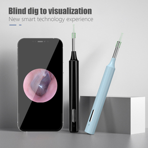 Design Ergonomico e Sicuro, Otoscopio Smart WiFi e Microscopio Digitale, Pulitore Auricolare Wireless Visuale 4.3mm 1080p - Product Image 6