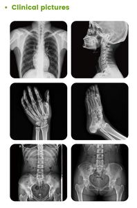 Kỹ thuật số chụp <span class=keywords><strong>x</strong></span> quang hệ thống 32kw Single-phase 110V tiên tiến cột đôi <span class=keywords><strong>X</strong></span>-<span class=keywords><strong>Ray</strong></span> máy cho bệnh viện - Product Image 6