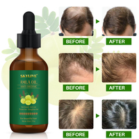 Huile de croissance capillaire à l'amla bio pour la repousse des cheveux et l'hydratation du cuir chevelu, soin de la barbe, extrait d'amla indien, huile de croissance des cheveux, vente chaude