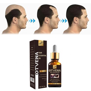 น้ำมันบำรุงผมขิง 100% ช่วยเร่งผมยาวเห็นผลในปี 2023 ป้องกันผมร่วง - Product Image 1
