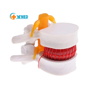 真人大小人体解剖腰椎间盘突出症模型环保PVC 11x12x10cm优秀医学科学教学学习 - Product Image 1