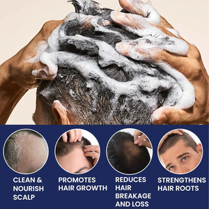 OEM nhà máy bán buôn thuần chay chăm sóc tóc mất dầu gội mọc lại mỏng tóc dày Biotin tăng trưởng tóc dầu gội cho nam giới - Product Image 2