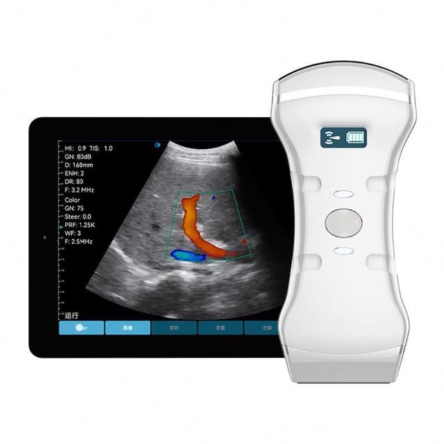 Multifunctional Portable Ultrasound Machine Wireless Probe Ultrasound