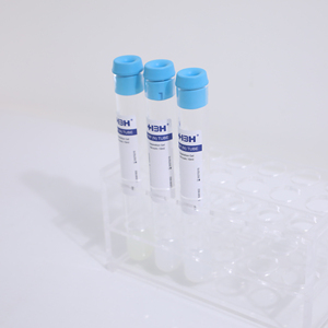 Provetta PRP Certificata CE per Applicazioni Mediche Sicure e Conformi al Mercato dell'Unione Europea - Product Image 5