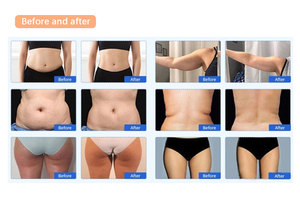 First Choice Lymphatic Drainage Device Body Shaping Body Slimming Skin Tightening <b>Weight</b> Loss Body Massager for Salon - Product Image 6