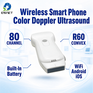 Sonde d'échographie sans fil EUR VET R60 Convexe 80 canaux, scanner Doppler couleur, appareil de poche WiFi Android iOS avec batterie intégrée - Product Image 1