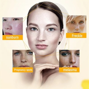 Crema Blanqueadora y Reafirmante OEM y ODM, Crema para Eliminar Manchas Oscuras para el Tratamiento del Melasma - Product Image 3