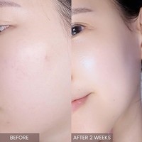 Crème hydratante et lissante pour le visage à l'arbre à thé rose, anti-rides, au collagène, pour l'exportation