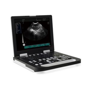 Ecógrafo Veterinario Portátil Tipo Laptop con Modo B para Vacas, Caballos y Ovejas, Dispositivo de Imagenología por Ultrasonido, Máquina de Ultrasonido Veterinaria - Product Image 2