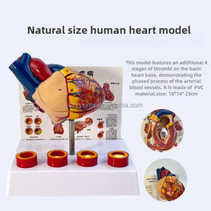 Modelo anatómico <span class=keywords><strong>de</strong></span> corazón humano <span class=keywords><strong>de</strong></span> tamaño real desmontable con trombo para ciencia médica - Product Image 3