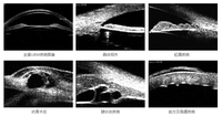 Échographe ophtalmique UBM (A/B/P/UBM) à échelle complète, scanner oculaire, équipement d'ophtalmologie SW-3200S
