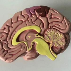 Modèle de maladies secondaires du diabète KyrenMed Modèle d'organe humain Modèle de diabète pathologique comprenant 8 parties Ensemble de diabète de type 2 - Product Image 4